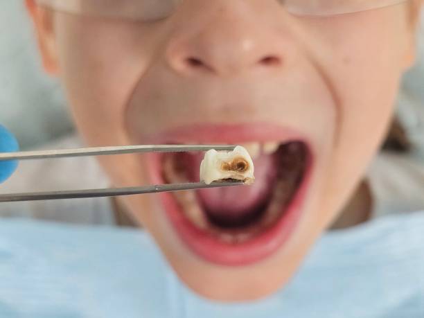 Best Orthodontic Emergency Dentist in Oelwein, IA