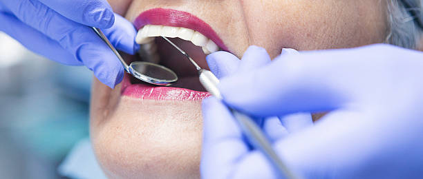 Best Emergency Dentist for Knocked-Out Tooth in Oelwein, IA